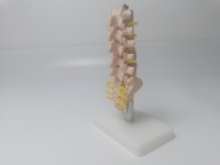 Modelo Anatómico Humano de Columna Vertebral con Vértebras Lumbares, Sacro y Coxis, y Hernia Discal, Tamaño Real, para Enseñanza Médica