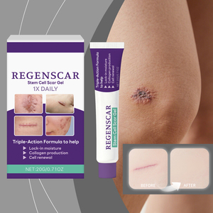 Crema para Eliminar Cicatrices, Hiperplasia, Quemaduras, Lesiones por Escaldaduras, Cicatrices Quirúrgicas, Estrías, Eliminador de Cicatrices y Marcas - Product Image 4