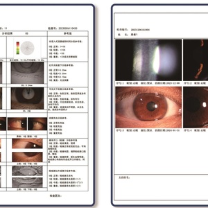 Testeur et détecteur complet et polyvalent pour l'analyse de la sécheresse oculaire tout-en-un, du lacrimal au gland, outil de diagnostic de la sécheresse oculaire DEA-800 - Product Image 5