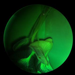 ליבה אופטית קולפוסקופ n 2200bi אבחון רפואי נייד קולפוסקופיו נייד ג 'ינאקולוגי לבדיקת הנרתיק - Product Image 5