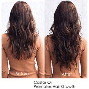 <span class=keywords><strong>Olio</strong></span> di ricino puro al 100% spremuto a freddo biologico con <span class=keywords><strong>olio</strong></span> di ricino privo di esano che guarisce per la pelle secca, ciglia per la cura dei capelli per la crescita dei capelli - Product Image 2