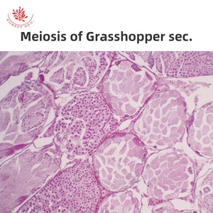 Preparaciones de <span class=keywords><strong>Microscopio</strong></span> de División Celular, Multiplicación de Raíz de Cebolla L.S., Meiosis de Saltamontes Sec. <span class=keywords><strong>Mitosis</strong></span> de Animales Sec. Huevo de Parascaris - Product Image 3