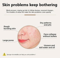Kit de peeling aux algues 99% OEM, biomicroneedling, spicules d'éponge, masque en poudre de peeling aux algues naturel, peeling biologique du visage, acné