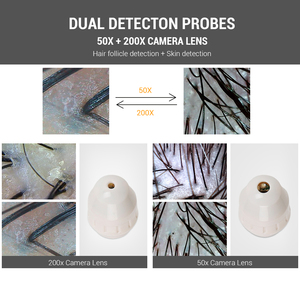 Chất lượng cao giá thấp HD nang tóc da đầu Scanner Detector tóc Analyzer/da đầu tóc Máy phân tích - Product Image 5