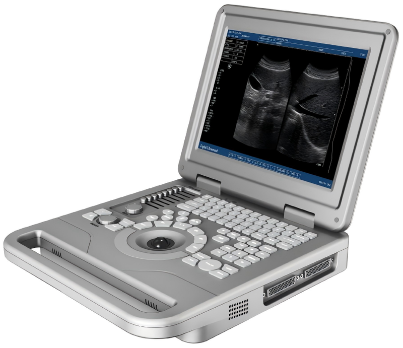 Digital Portable Ultrasound Scanner with Convex