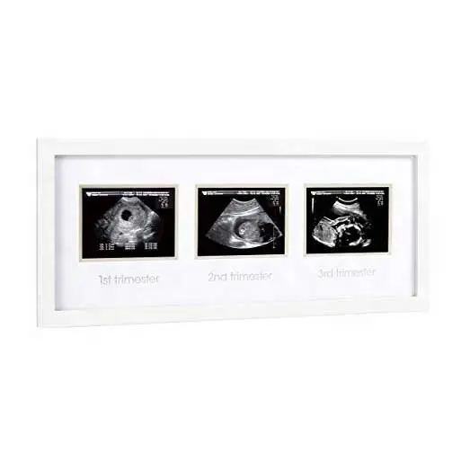 Bingkai Foto Tiga Sonogram, Bingkai Kenang-kenangan Kehamilan Putih 8X17 Tripel untuk Arloji Bayi Hadiah Hebat