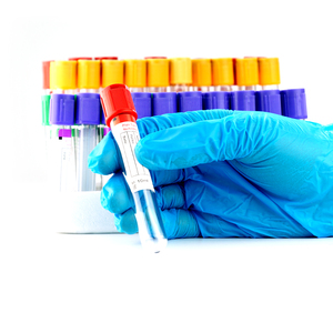 혈액 채취용 PET 유리 일반 진공 튜브 (실험실용) - Product Image 1