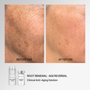 Kit de solution de micro-infusion REGENEX personnalisé OEM ODM, Matrixyl 3000 Peptide pour la réparation cellulaire, le raffermissement et l'anti-âge, marque privée - Product Image 5