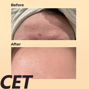 Eigenmarke 100 ml Schnecken-Musin 96% Essenzserum koreanische Hautpflege Leistungsreparatur beschädigte Haut flüssiges Gesichtserum