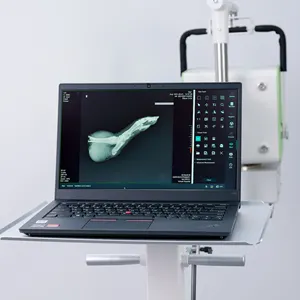 Équipement médical vétérinaire radiographique pour animaux de compagnie 5kW/100mA Machine vétérinaire mobile portable à rayons X vétérinaire à rayons X pour animaux