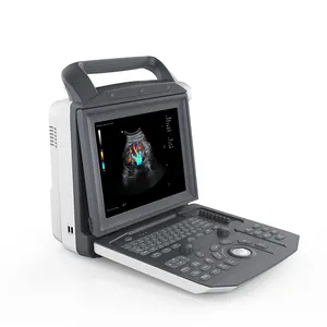 Draagbare Volledige Digitale Kleur Doppler Ultrasound Machine Medische Scanner Echografie