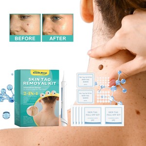 Wholesale <strong>Skin</strong> <strong>Tags</strong> <strong>Removal</strong> Kit <strong>Skin</strong> <strong>Tags</strong> Remover Bands Kit <strong>Skin</strong> <strong>Tags</strong> Repair Skincare Products - Product Image 4