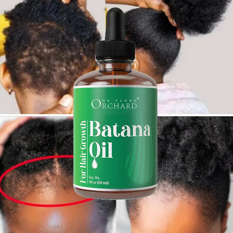 Best Seller Pure Organic Hair Oil With Jamaican Black Castor Nourish Hair Follicles Batana Hair Growth Oil