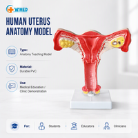 Modèle d'anatomie scientifique médicale, utérus et ovaires humains pour l'enseignement médical et les services d'enseignement