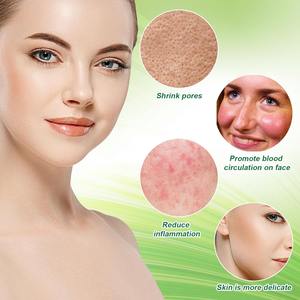 Molde <span class=keywords><strong>de</strong></span> silicona para cubitos <span class=keywords><strong>de</strong></span> <span class=keywords><strong>hielo</strong></span> con forma <span class=keywords><strong>de</strong></span> cuenco facial, bandeja <span class=keywords><strong>de</strong></span> <span class=keywords><strong>hielo</strong></span> integrada, cuenco plegable portátil para baño <span class=keywords><strong>de</strong></span> <span class=keywords><strong>hielo</strong></span> para spa <span class=keywords><strong>en</strong></span> casa, sin BPA, venta al por mayor - Product Image 5