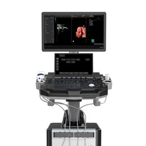 अनुकूल मानक 21.5 इंच मॉनिटर ट्रॉली रंग डॉपलर अल्ट्रासाउंड - Product Image 1