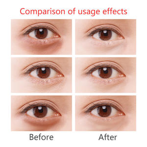 רטינול פפטיד סרום לעיניים אנטי אייג'ינג מיצוק הפחתת קווים עדינים החלקת קמטים שיפור צניחת עיניים קל משקל ספיגה מהירה - Product Image 5