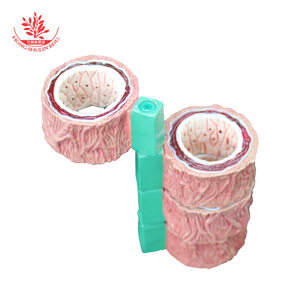 Modèle vasculaire, spécimen vasculaire pathologique en quatre étapes, démonstration de communication médecin-patient en cardiologie, vasculaire - Product Image 2