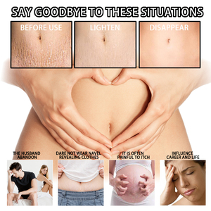 <span class=keywords><strong>Meilleure</strong></span> crème efficace au collagène pour les vergetures crème pour enlever les cicatrices crème nourrissante pour le traitement intensif des vergetures crème pour les femmes - Product Image 5