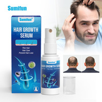Sérum Capillaire Soin du Cuir Chevelu Marque Blanche 30ml Formule Végétale Soin Quotidien Nutrition Racine Capillaire pour Cheveux Affinés