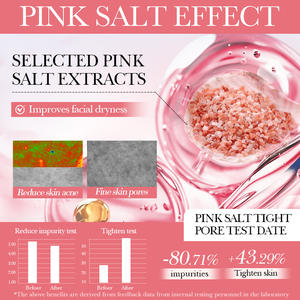 Esencia Hidratante SADOER con Sal <span class=keywords><strong>Rosa</strong></span> del Himalaya, Cierra los Poros, Esencia con Ácido Hialurónico, Producto para el Cuidado de la Piel, Venta al por Mayor - Product Image 3