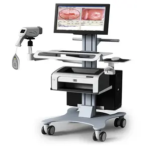 Video Digital Colposcope Imaging System Female Vaginal Test Camera Colposcopy Machine