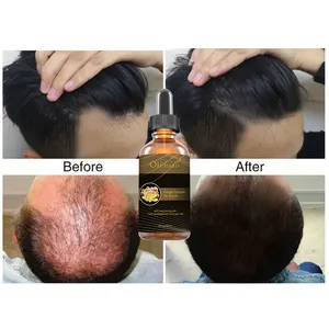 Private Label Hair Care Natural Organic Smoothing Repairing Anti Loss Herbal Turmeric Hair Growth Oil Serum