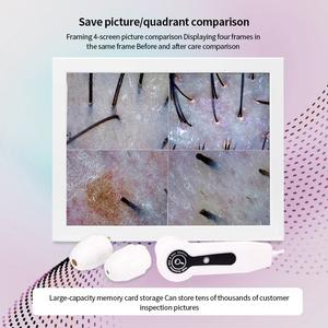 Nouvel arrivage : Scanner HD pour l'analyse des follicules pileux du cuir chevelu avec grille de comparaison avant-après et loupe pour analyse faciale en salon de beauté (Wi-Fi) - Product Image 3