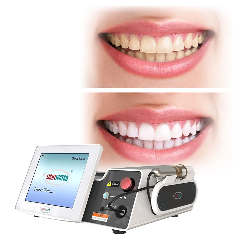 980nm Zacht Weefsel Tandheelkundige Diode Laser Voor Orale Chirurgie 650nm 1470nm Tandheelkundige Lasermachine 3-Golflengte Laser Tandheelkundige Apparatuur