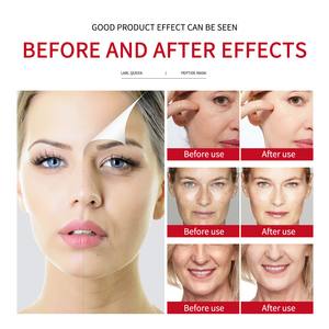 OEM etiqueta personal personalizada cuidado de la piel paquete colágeno relleno reparación reafirmante limpiador cara crema ojos <span class=keywords><strong>serie</strong></span> de esencia - Product Image 4