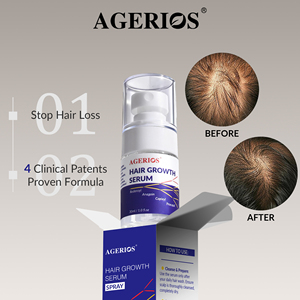 <span class=keywords><strong>Spray</strong></span> Acelerador del Crecimiento del Cabello para Cuero Cabelludo Sensible, <span class=keywords><strong>Bloqueador</strong></span> de DHT con Aminoácidos, Fortalece los Folículos, Agrega Volumen, Apoya el Crecimiento Natural del Cabello - Product Image 1