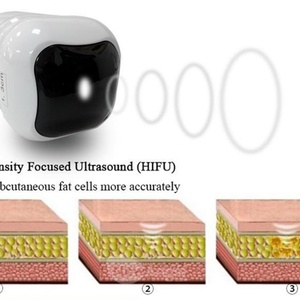 Massage Head Connector for Warm Massage Machine - Product Image 6