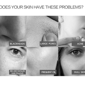 Vente en gros de masque de boue de la mer Morte pour le soin de la peau du visage, 200 g, nettoyage en profondeur, réduction des pores - Product Image 3