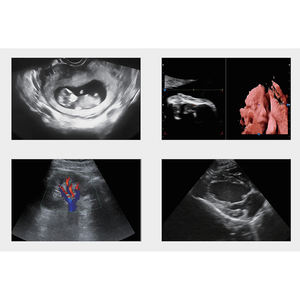 Escáner de Ultrasonido 4D Equipo Médico de Ultrasonido Instrumento de Diagnóstico por Ultrasonido en Color de Alta Definición - Product Image 5