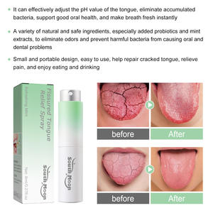 Portable 8-milliliter Oral Care Spray for Tongue Fissure Repair, Providing Fresh <b>Breath</b>, Coolness and Mint Flavor - Product Image 5