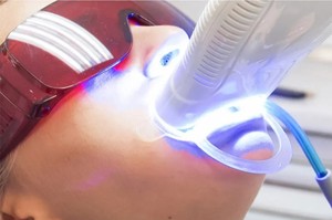 ที่เปิดปากสำหรับทันตแพทย์จัดฟันฟันฟันฟันขาวเครื่องมือทันตกรรมแบบใช้แล้วทิ้ง - Product Image 5