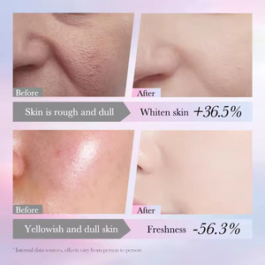 Productos de Cuidado de la Piel con Niacinamida de Marca Privada OEM, Loción Facial Blanqueadora, Nutritiva, Reafirmante y Reparadora de Manchas - Product Image 4