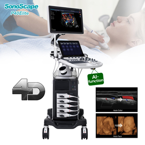 Diagnostic assisté par l'IA <span class=keywords><strong>Sonoscape</strong></span> P40 Elite Machine à ultrasons Doppler couleur numérique 3D 4D Maquina De Ultrasonido pour la cardiologie - Product Image 1
