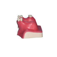 Implante Dental de Venta Directa de Fábrica, Simulador de Seno Maxilar con Encía Suave, Certificación CE/ISO