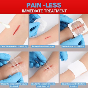 Cierre de heridas con cremallera médica Zip Stitch, marca privada, para ataduras, dispositivo de emergencia, 2 unidades, suturas, tira de cierre de heridas - Product Image 2