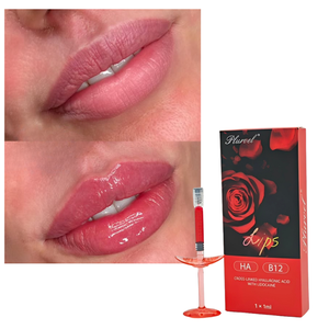 Remplisseur monophasé HA réticulé efficace avec VB12 pour l'<span class=keywords><strong>augmentation</strong></span> des lèvres et la réparation des rides - Product Image 2