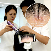 Scalp Hair Analysis Microscope WIFI Dual Light Source AI Smart Detector for Beauty Salon Home Scalp Care Hair Follicle Detection