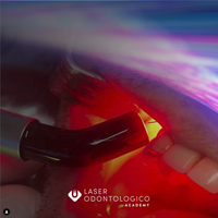 2023 laser à diode dentaire à trois longueurs d'onde pour la chirurgie des tissus mous traitement oral blanchiment des dents équipement de beauté
