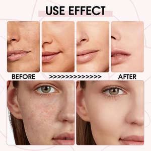 Suero facial iluminador sin parabenos rico en antioxidantes nutritivo agua de rosas y vitamina E antienvejecimiento hidratante y lucha contra la opacidad - Product Image 5