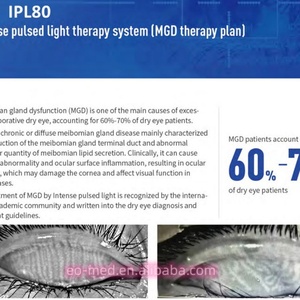 IPL80 - Máquina de Terapia de Luz Pulsada Intensa Portátil y Económica para el Tratamiento del Ojo Seco, Mejora la Estructura del Borde del Párpado, en Venta - Product Image 5