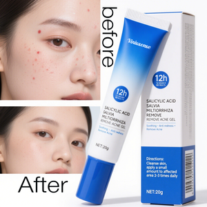 Vinissense vente en gros nourrissant apaisant barrière d'hydratation dommages se débarrasser des <span class=keywords><strong>boutons</strong></span> d'acné supprimer <span class=keywords><strong>les</strong></span> points noirs crème anti-acné - Product Image 1