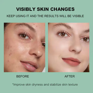 Masker Wajah Teh Hijau Mawar Label Pribadi Anti Penuaan Anti Kerut Dengan Kolagen dan Gliserin Melembapkan Perawatan Wajah - Product Image 4