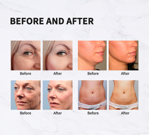 Taibo 7D 2-en-1 HIFU Anti-âge Lifting Facial et Vaginal Appareil de Beauté Professionnel Prix Machine HIFU Nettoyage du Visage Brosse - Product Image 6