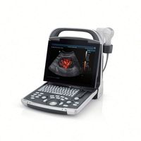 Sistema de Diagnóstico por Imágenes y Ecógrafo Mindray DP-30 Totalmente Digital con Carro