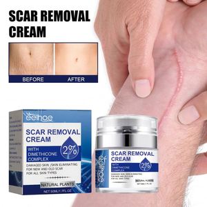 <span class=keywords><strong>Crema</strong></span> Reparadora de Cicatrices EELHOE, Hidratante y Suavizante de la Piel con <span class=keywords><strong>Aloe</strong></span> <span class=keywords><strong>Vera</strong></span>, Desvanece Cicatrices de <span class=keywords><strong>Embarazo</strong></span> y Quirúrgicas, Antiarrugas para el Cuerpo de la Mujer - Product Image 5